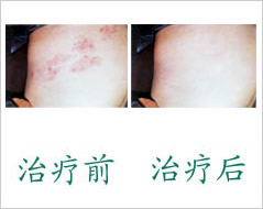 ݡҽԺ?Ŵݡ֢״ݡǰף 
ؼ: